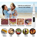 Smart Ultra-Sonic Teeth Cleaner